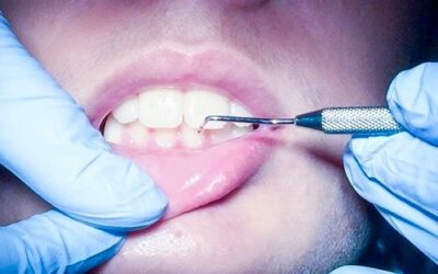 Una buona abitudine per un sorriso perfetto, scopri tutto sulla pulizia dei denti a Busto Arsizio