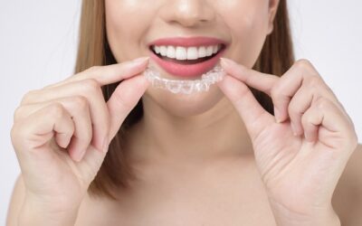 Perché scegliere gli apparecchi Invisalign a Saronno per un sorriso perfetto