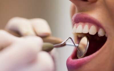 Dentista a Castellanza: cure, prevenzione e soluzioni per un sorriso sano